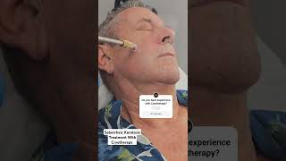 Seborrheic Keratosis treatment on the face with Cryotherapy medicalprocedurevideos dermatologist [upl. by Eniger41]