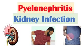 Pyelonephritis Kidney Infection  Causes Pathophysiology Signs amp Symptoms Diagnosis Treatment [upl. by Adnih]