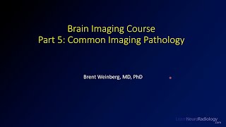 Brain imaging course – 5 – Common imaging pathology [upl. by Nuli]