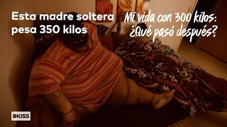 Obesidad extrema Mercedes pesa 350 kilos  Mi vida con 300 kilos ¿Qué pasó después [upl. by Emeric774]