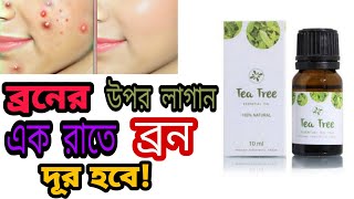 ব্রনের উপর লাগালে ব্রন চলে যাবে  টি ট্রি অয়েল tea tree oil  khadija begum [upl. by Driskill334]