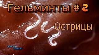 Гельминты 2 Острицы  Worms 2 Pinworms [upl. by Blodget]