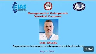 Management of Osteoporotic Vertebral Fractures quot Augmentation techniquesquot [upl. by Ajad69]