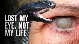 How to Survive a Spitting Cobra Attack [upl. by Slayton]