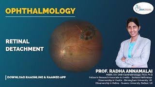 Ophthalmology  Retinal detachment  Raaonline [upl. by Hayifas620]