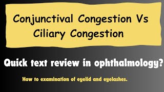 How to differentiate between Conjunctival Congestion and ciliary Congestion OptometryFans [upl. by Kazim]