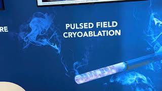 Cryo ablation et Electroporation en même temps [upl. by Oidualc]