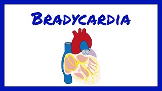 Bradycardia  Bradyarrhythmia [upl. by Derte]