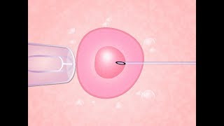 Fertilização in vitro O Passo a Passo [upl. by Hekking]