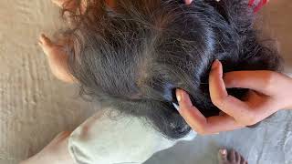 ASMR Lice and Nits Removal for Ultimate Scalp Check  Satisfying [upl. by Amaso]