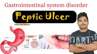 Peptic ulcer disease  why peptic ulcer cause  how to control stomach pain [upl. by Aikrahs]