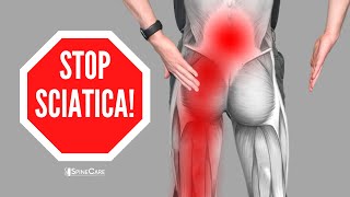 How to Relieve Sciatica Pain in SECONDS [upl. by Daveda]