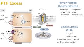 Hypercalcemia and Hypocalcemia [upl. by Eceinal]