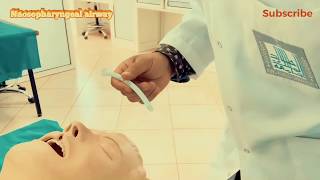 Nasopharyngeal Airway insertion [upl. by Heeley623]