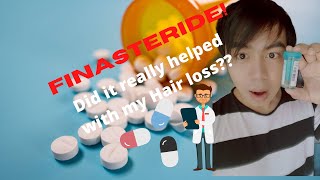 8th month review with FINASTERIDE for HAIR LOSS Filipino [upl. by Myna]