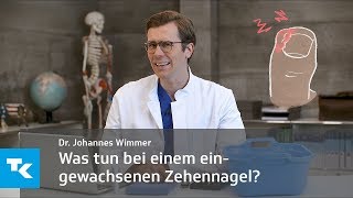 Was tun bei einem eingewachsenen Zehennagel  Dr Johannes Wimmer [upl. by Acirema]