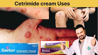 Uses of Cetrimide creamsavloncreamburnloncream [upl. by Merline759]