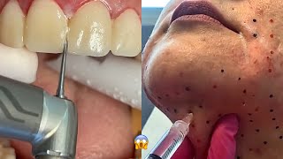 Most Extreme Beauty Treatments 2022 Best Smart and Helpful Beauty Hacks  Virtual Beauty [upl. by Hoashis]