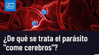 Parásito ‘come cerebros’ terminó con la vida de una niña en Colombia [upl. by Ahsinahs]