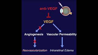 AntiVEGF for the treatment of Retinal Diseases  ANCHOR MARINA BRAVO CRUISE DRCR Protocol I [upl. by Darnok]