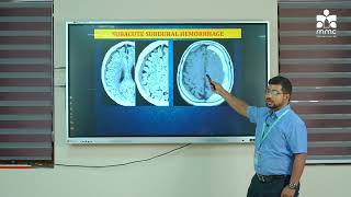 RADIODIAGNOSIS INTRACRANIAL HAEMORRHAGES [upl. by Agiaf]