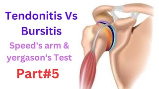 Difference between tendonitis vs Bursitis  Bicipital tendonitis  special tests  speed arm test [upl. by Tosch361]