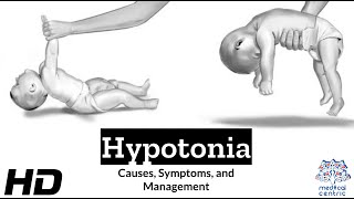 Hypotonia Explained What You Need to Know [upl. by Eiramadnil]