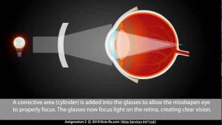 Astigmatism explained Easily Corrected With A Cylinder in Your Eyewear Glasses [upl. by Loomis237]