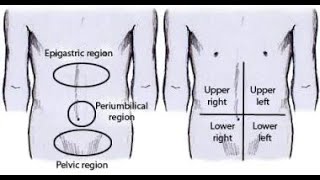 Physical Examination in Patients with Acute Abdomen [upl. by Kati]