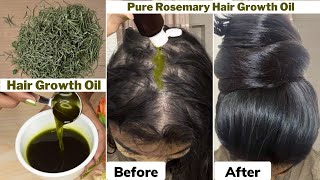 I used👆🏼this Rosemary Hair Growth Oil on Thinning Hair amp Bald ScalpGot 10 times Thick Hair Growth [upl. by Zapot]