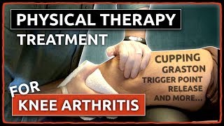 Physical Therapy Treatment for KNEE ARTHRITIS  Cupping Graston Trigger Point Release amp More [upl. by Macgregor]