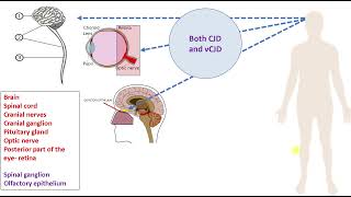 CreutzfeldtJakob disease CJD [upl. by Amaryllis858]