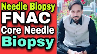 Needle Biopsy and Types  FNAC [upl. by Eddy731]