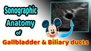 Sonographic anatomy of the gallbladder and biliary ducts [upl. by Sancha]