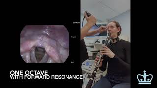 Laryngoscopy during Clarinet Performance [upl. by Mahalia]