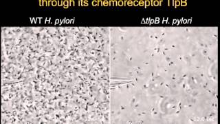 Helicobacter pylori Senses Urea as an Attractant through Its Chemoreceptor TlpB [upl. by Hedgcock392]