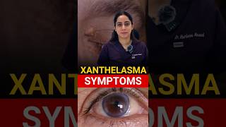 Most Common Symptoms Xanthelasma [upl. by Mian]