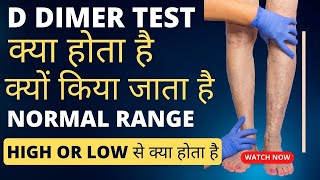 D dimer test kya hota hai  d dimer test in Hindi  d dimer normal range [upl. by Llenahc]