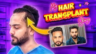 My Hairtransplant Journey  Elvish Yadav [upl. by Catriona]