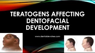 Teratogens Affecting Dentofacial Development [upl. by Nolyad]