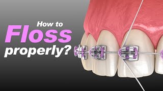 How to floss properly Tips for proper flossing [upl. by Anoel189]