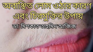 মেয়েদের মুখের অবাঞ্ছিত লোম দূর করার উপায় কি  Hirsutism [upl. by Darya]