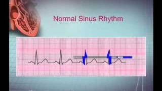 Intro EKG Interpretation Part 1 [upl. by Akema]