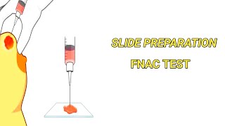 Slide Preparation For FNAC Test।। [upl. by Davis]