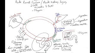 Understanding Acute Renal Failure Acute Kidney Injury  Simple Explanation [upl. by Lahcym453]