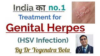 Genital Herpes  HSV INFECTION   Ka complete 100  Treatment [upl. by Yasdnyl]