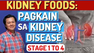 Kidney Foods Pagkain sa Kidney Disease Stage 1 to 4By Doc Willie Ong Internist and Cardiologist [upl. by Stander802]