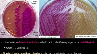 MacConkey Agar [upl. by Ahsimin34]