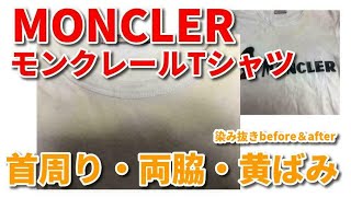 Ｔシャツ 黄ばみ 染み抜き クリーニング 【 MONCLER （モンクレール）Ｔシャツ 首周り ・ 脇黄ばみ 染み抜き 】 宅配クリーニング せんたく屋太郎 [upl. by Annoyk]