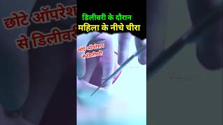 Normal delivery में छोटा ऑपरेशन chotaoperation episiotomy [upl. by Ytisahcal982]